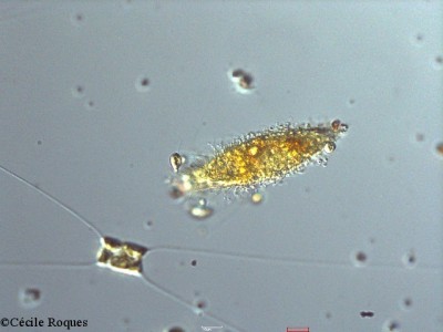 protozoo/Tiarina fusus (1)(copy)_thumb.jpg